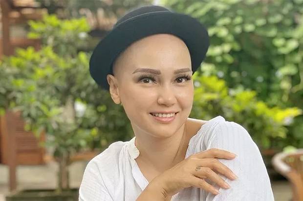 kisah-inspiratif-feby-febiola-bertahan-dari-kanker-sempat-terpukul-saat-alami-penyakit-mematikan-jmk